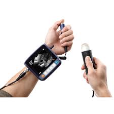 SUN-806F Vet Portable Digital Cheap Vet Ultrasound