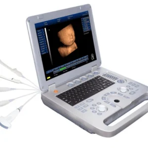 Sun 800d Full Digital PC-Based Color Doppler Ultrasound Machine